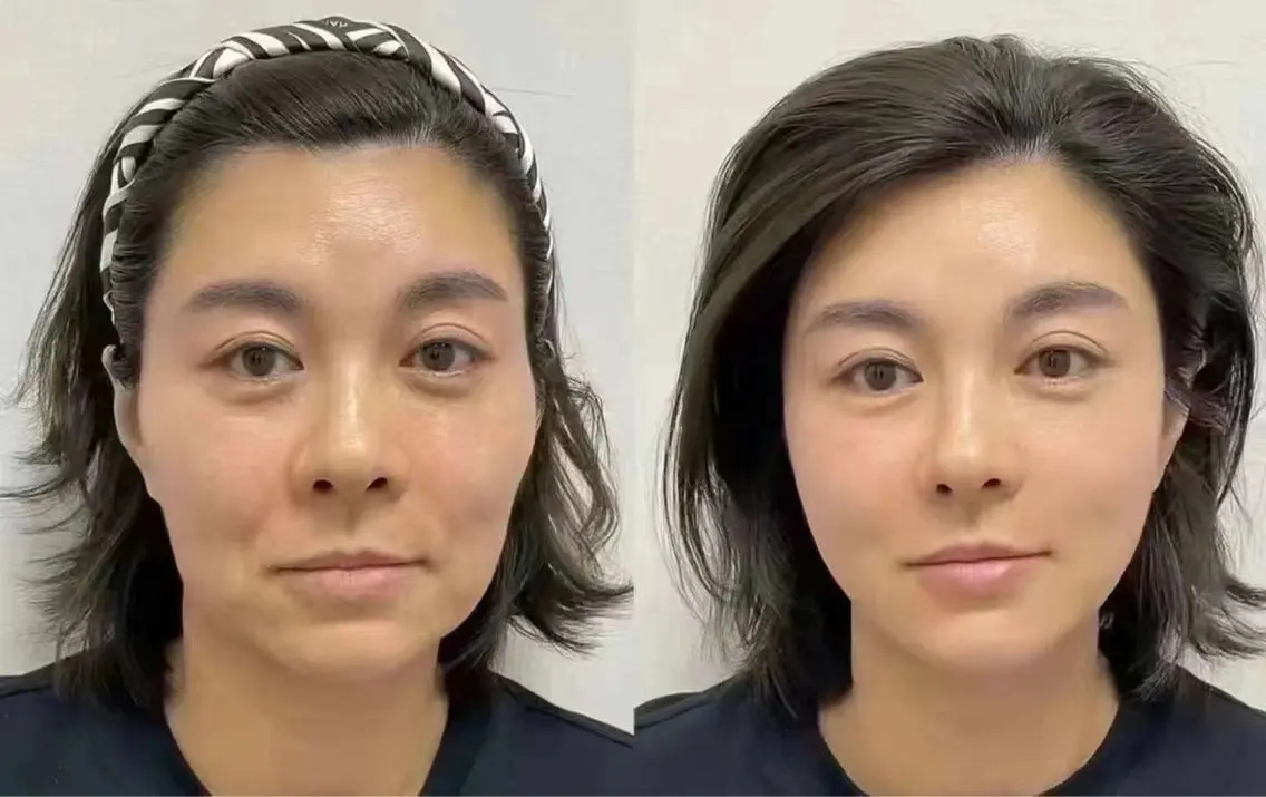 ネイル 愛維美水光専門店 川崎彩鳳のエステ・リラクイメージ