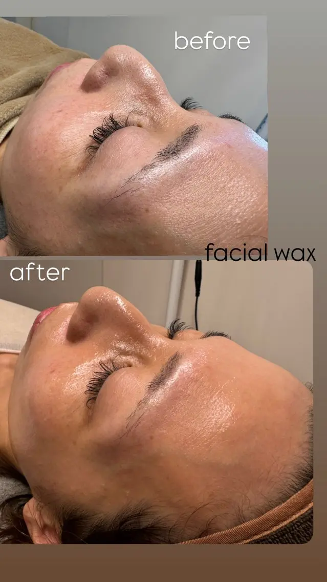 脱毛 なみ|WAX脱毛専門 店|さいたま市のエステ・リラクイメージ