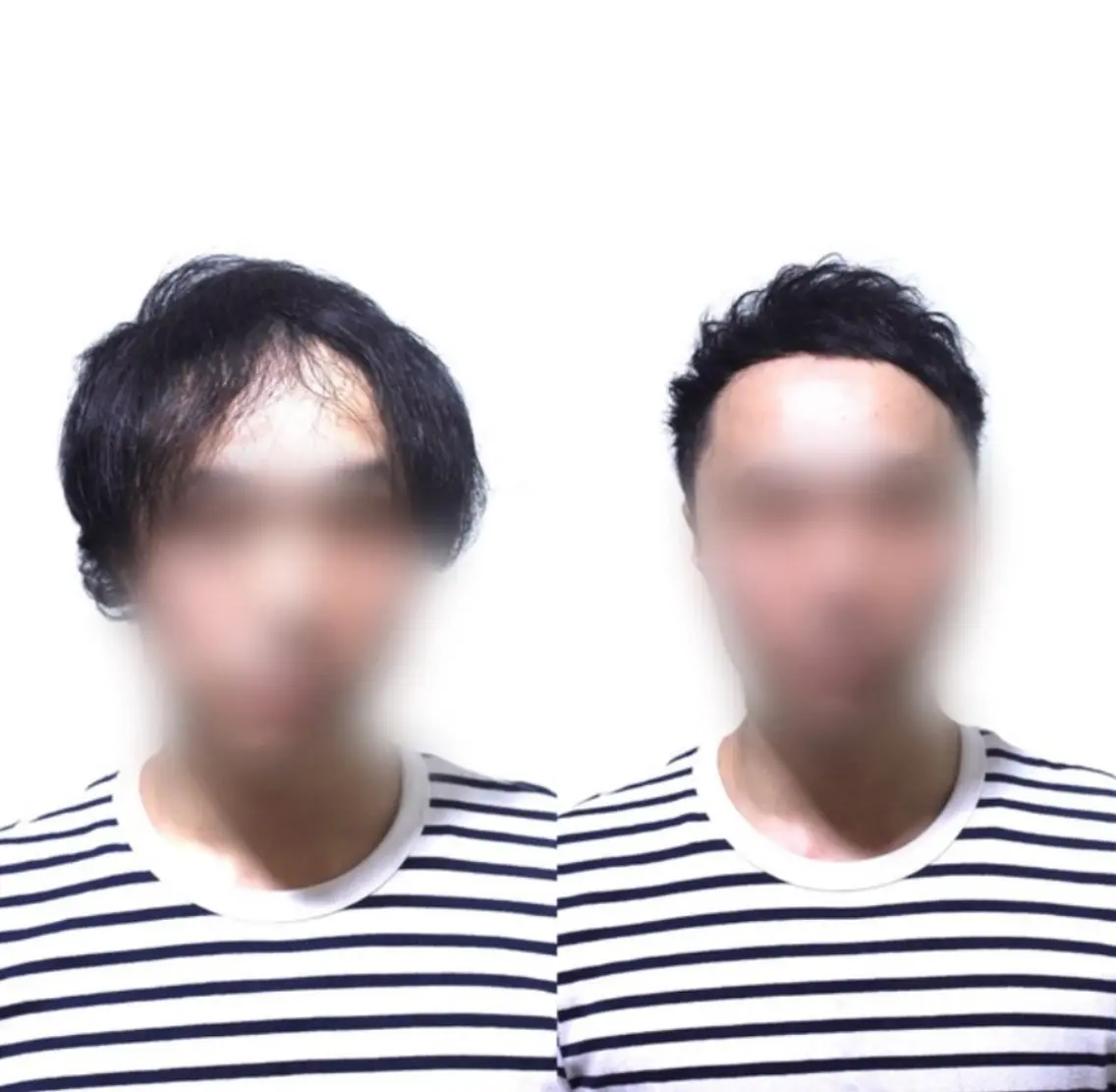 メンズ 薄毛専門美容師 和久井博のその他イメージ