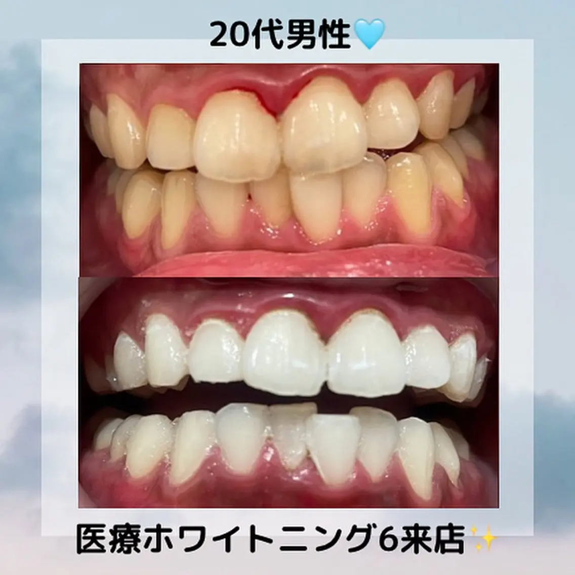 Kaula ホワイトニング🦷✨のエステ・リラクイメージ