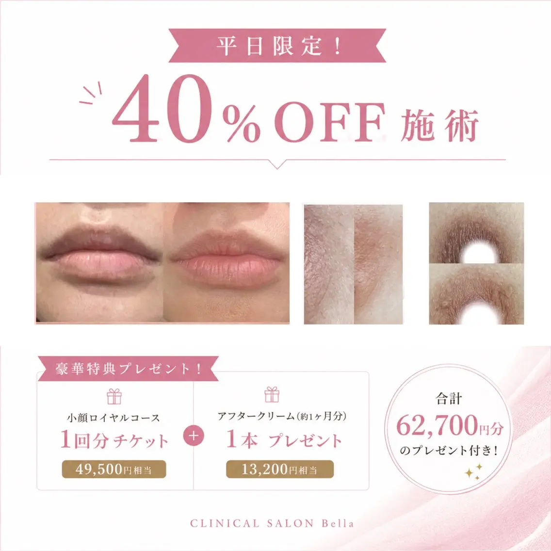 【平日♪ローマピンク】最新メラニンケア✨無料カウンセリング・当日施術の方の写真