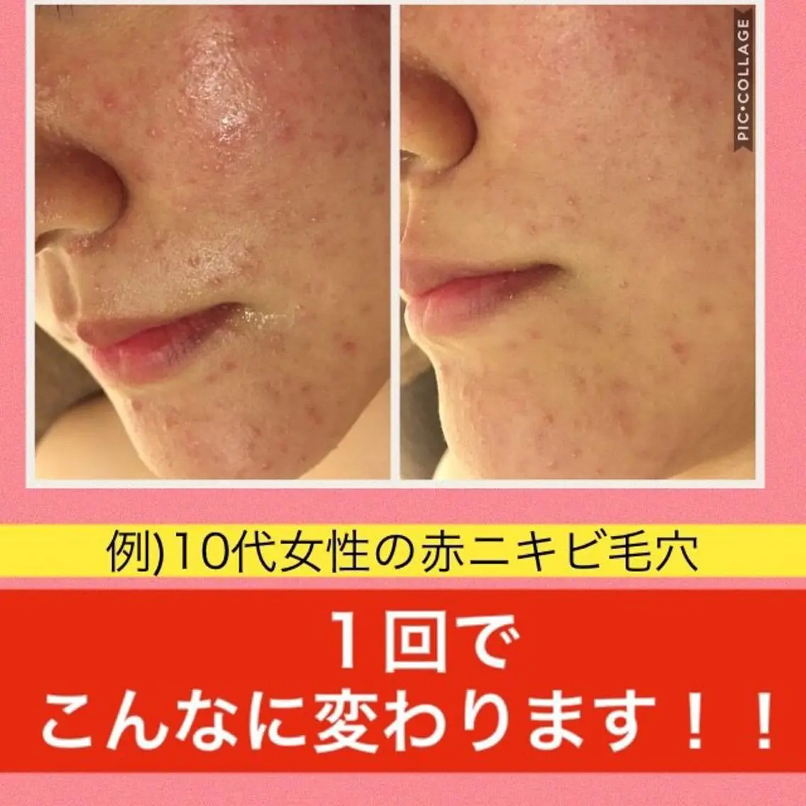 ミディアム カラー パーマ ヘアアレンジ メンズ キッズ ネイル マツエク・マツパ エステ リラク ニキビ・肌質改善専門 ♡人生が変わるサロンのエステ・リラクイメージ