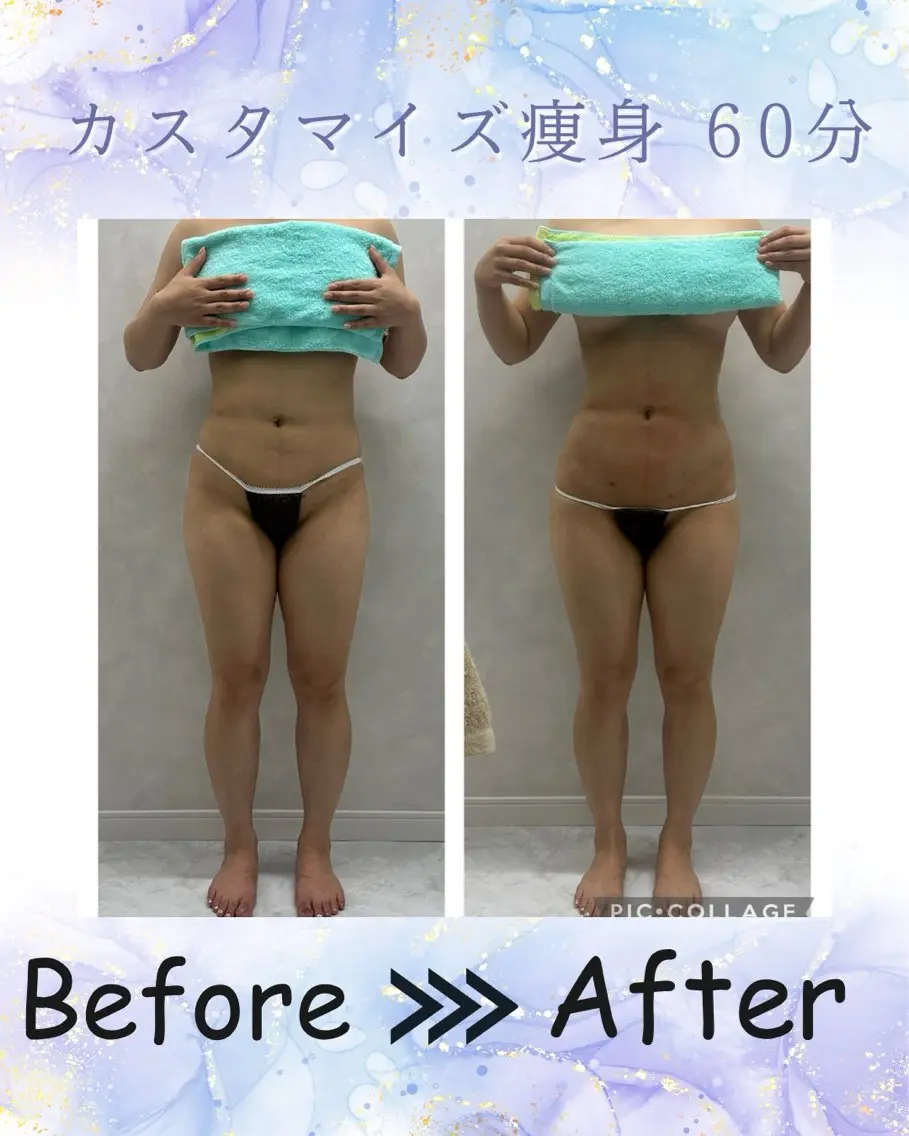 下っ腹ぽっこり🤰ヘソ出しファッションももう怖くない👊🔥カスタマイズ痩身60分✨️の写真