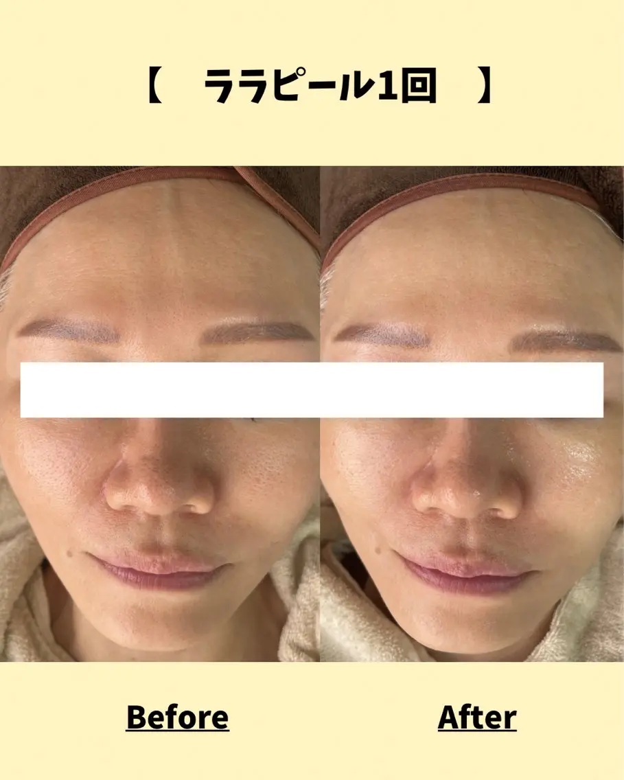 エステ 看護師施術美容サロン ナスサロ錦糸町　櫻内のエステ・リラクイメージ