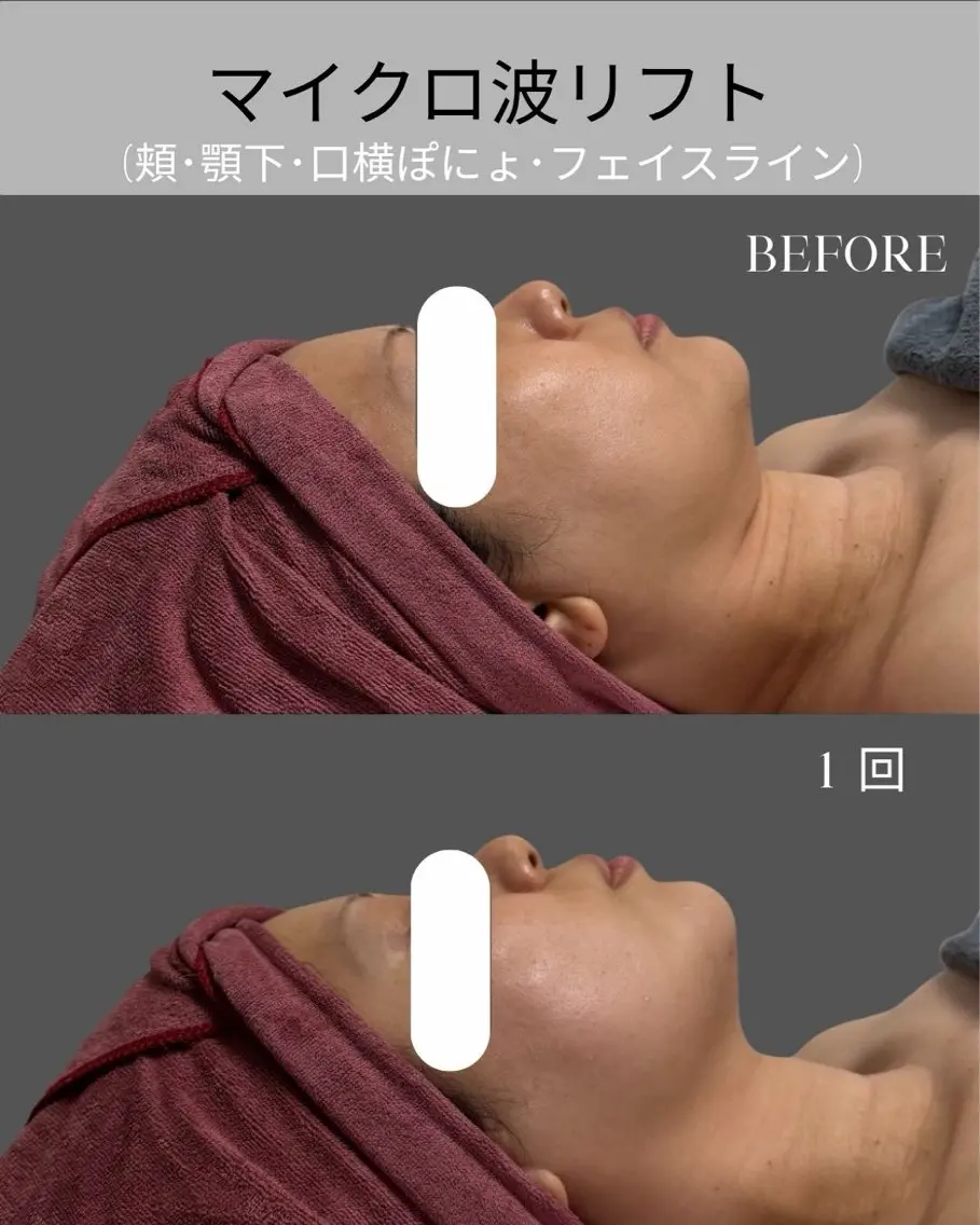 オンダリフト小顔･ ワックス脱毛×光脱毛のエステ・リラクイメージ