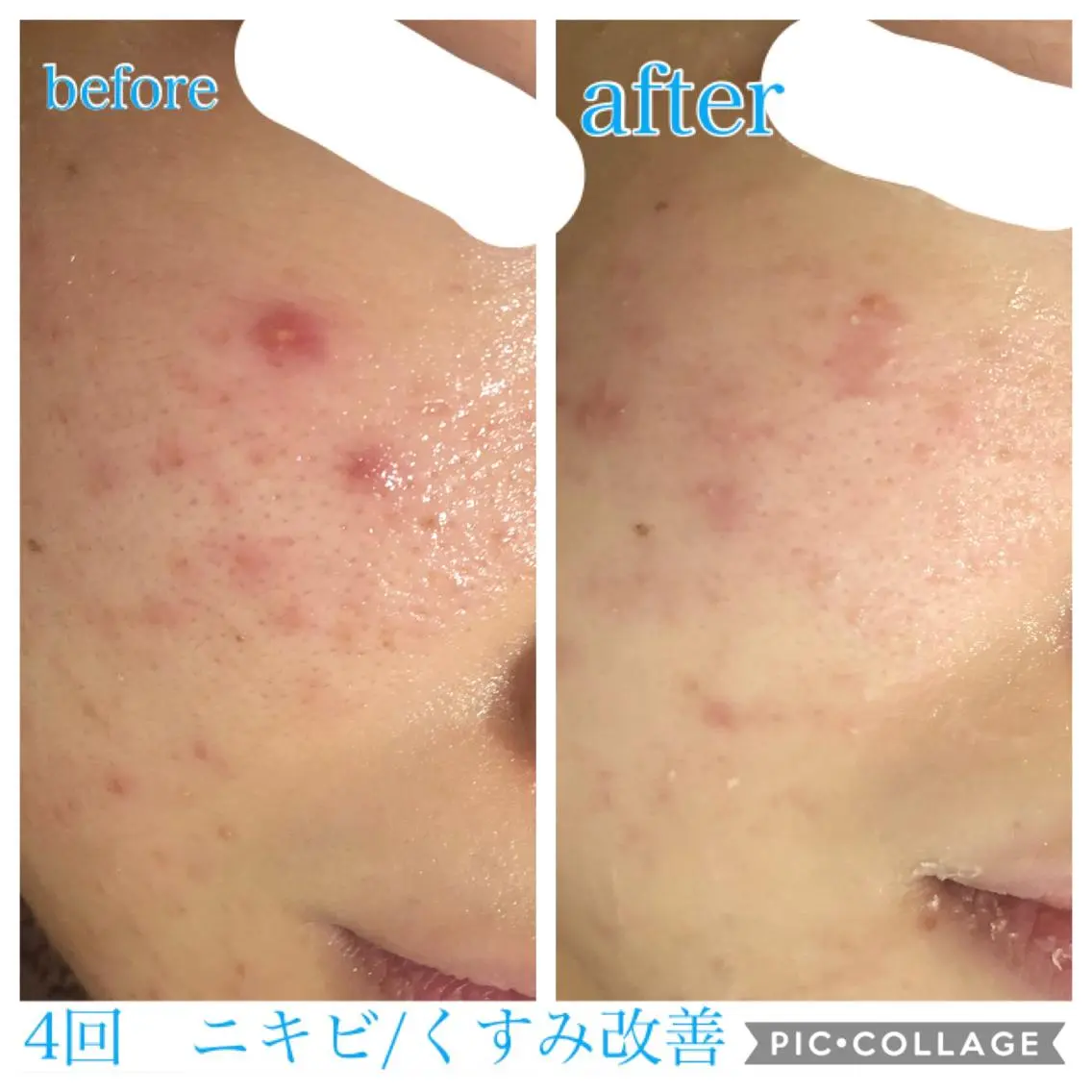 ロング カラー パーマ ヘアアレンジ メンズ キッズ ネイル マツエク・マツパ エステ リラク EnsorClair 代表 野口真央のエステ・リラクイメージ