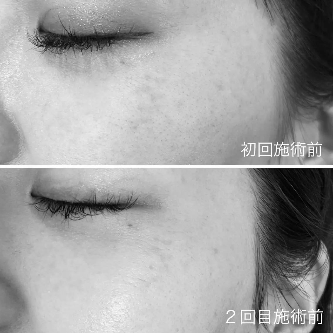 エステ Lassy keikoの眉毛・アイブロウイメージ