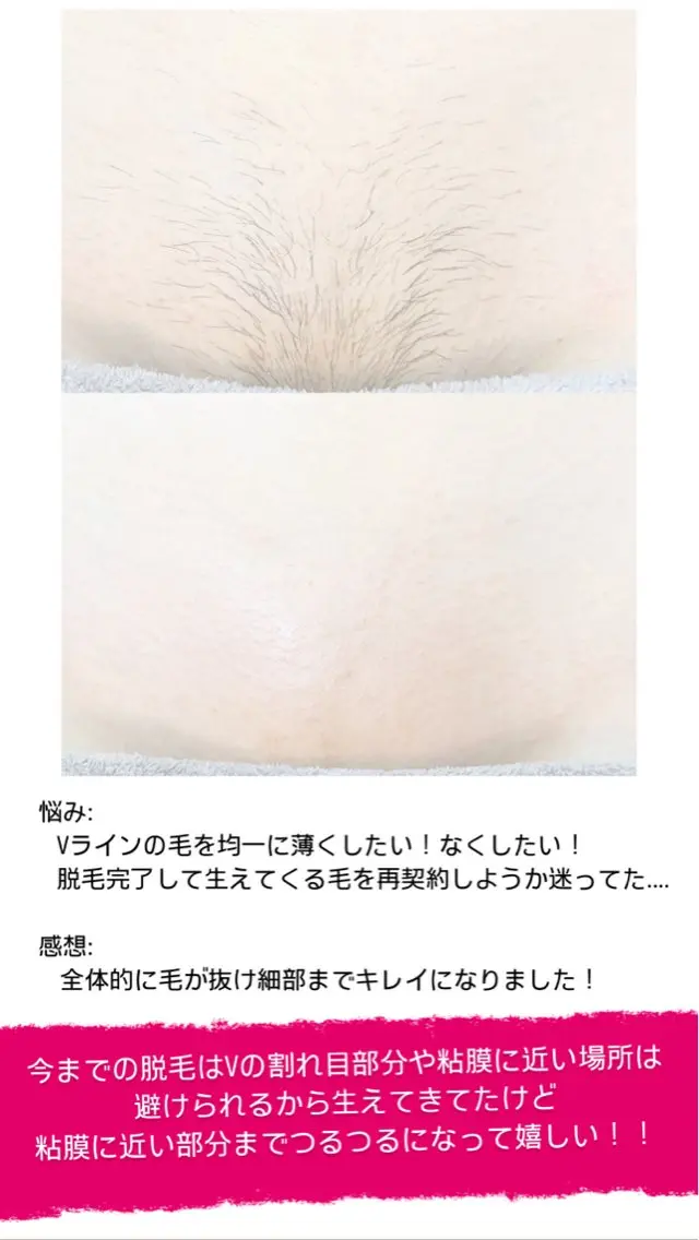 豊橋 ｜Hitomi シュガーリング専門店のエステ・リラクイメージ
