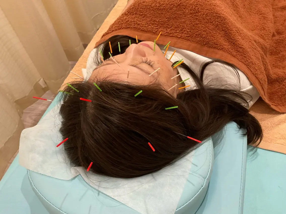 その他 けい整骨院 鍼灸院のその他イメージ
