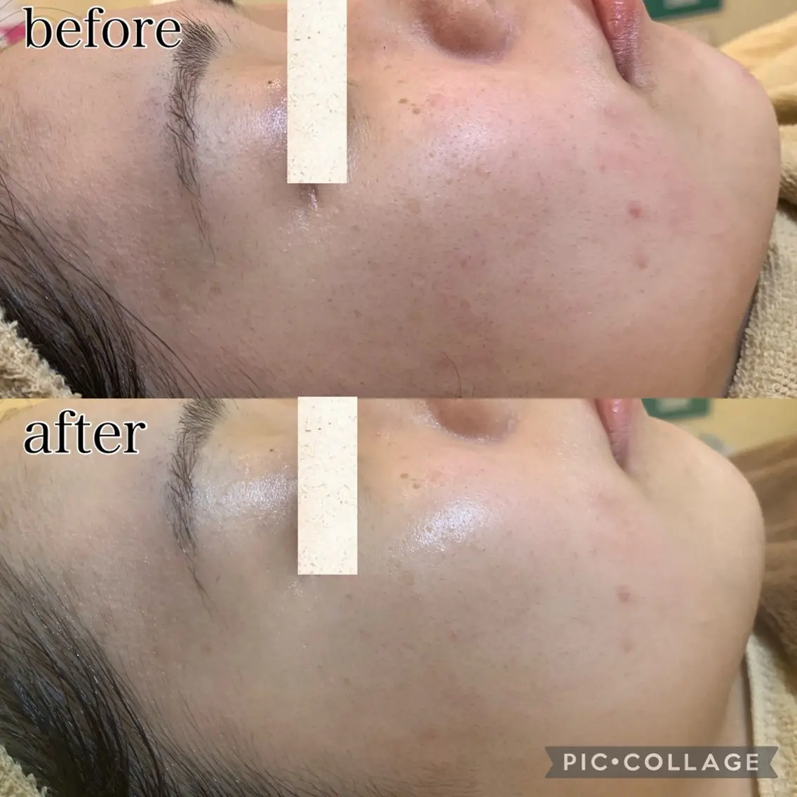 メンズ エステ Beauty Salonheartのエステ・リラクイメージ