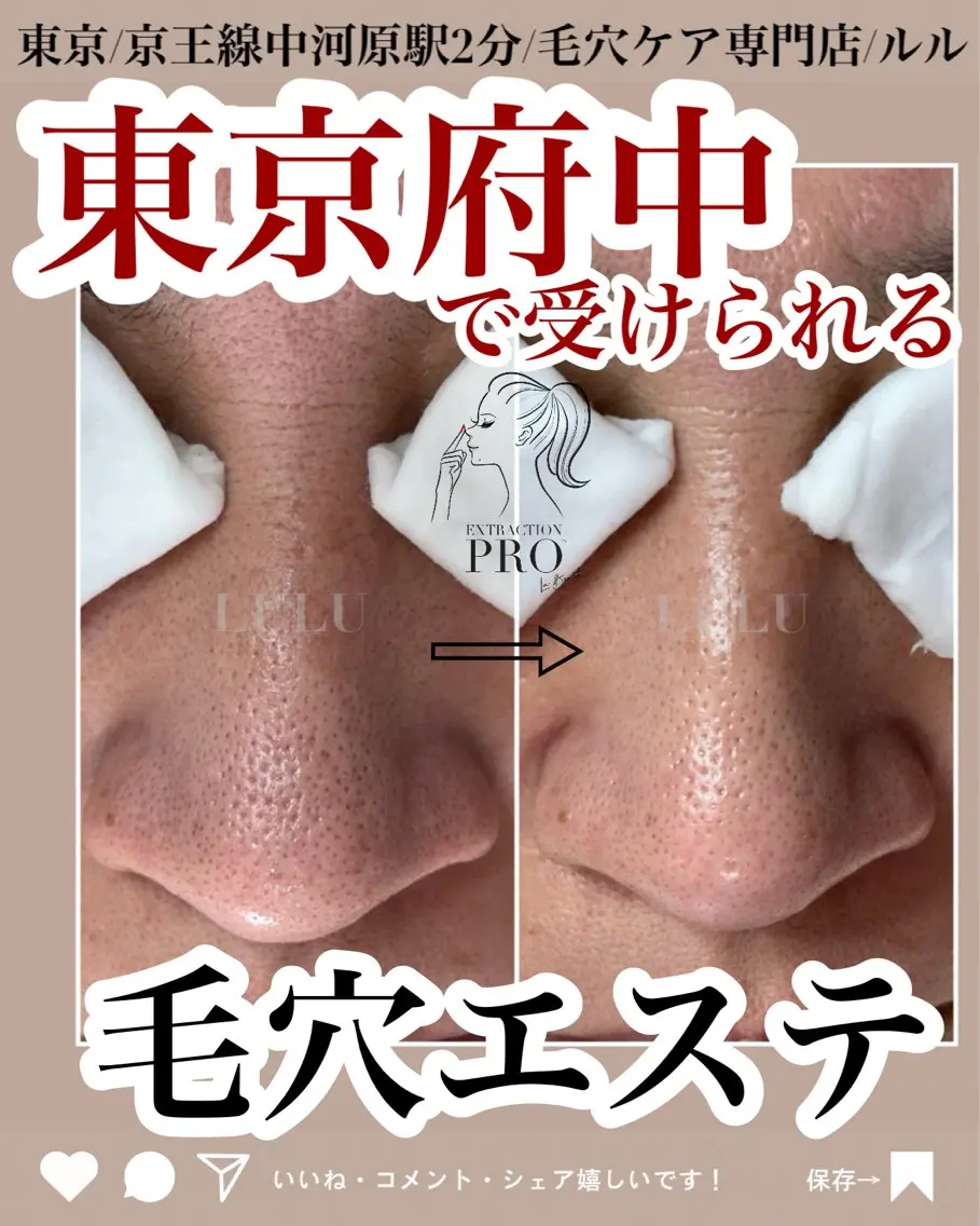 エステ LULU ルルのエステ・リラクイメージ