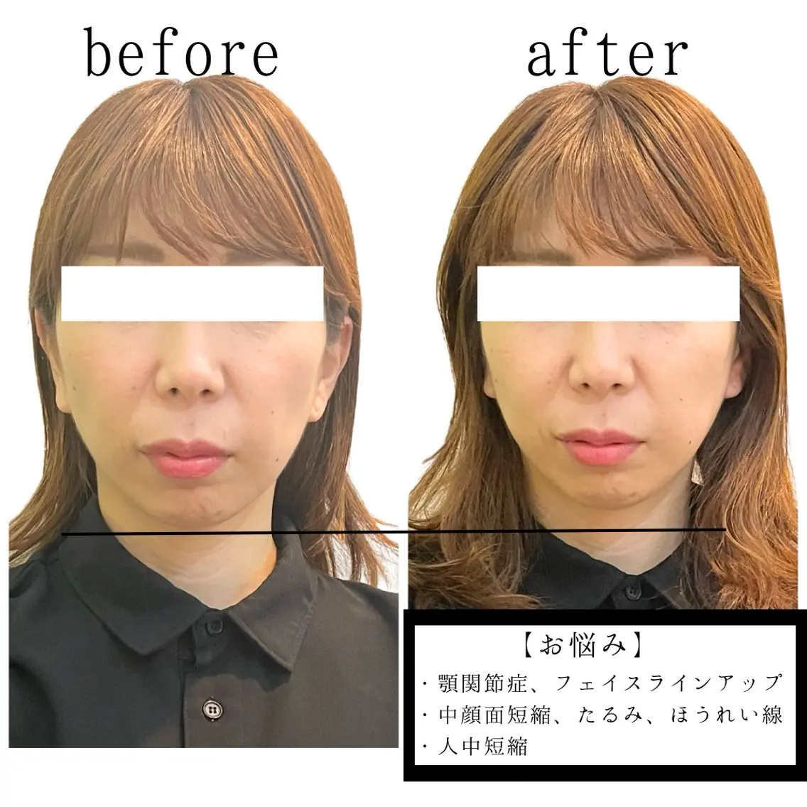 コアの木整骨院高津院 藤内尚志のエステ・リラクイメージ