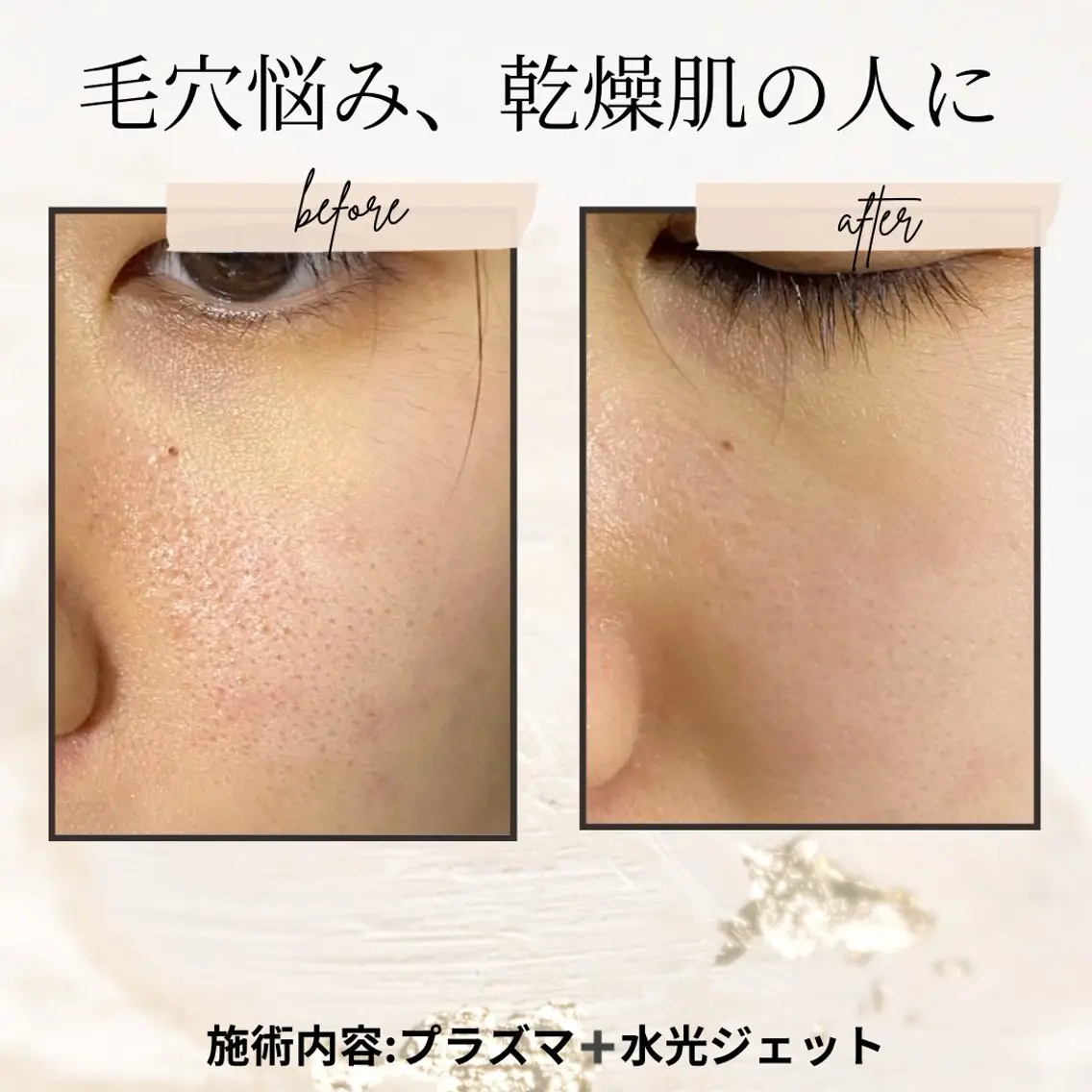 エステ リラク 愛維美水光美肌専門店 メンズレディースokのエステ・リラクイメージ