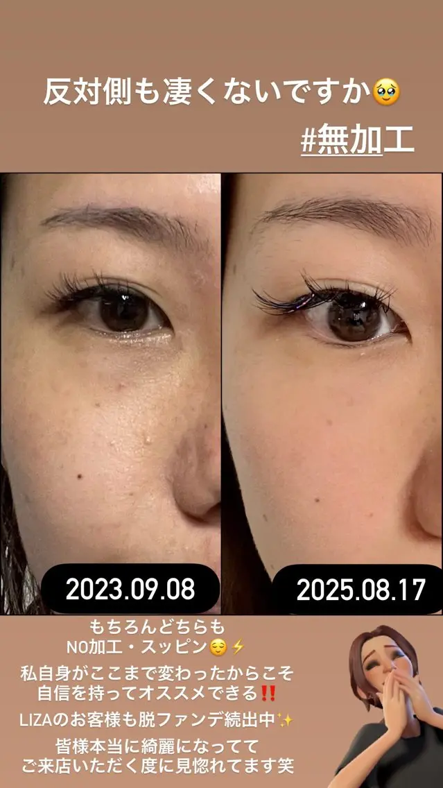 LiZA エステティックサロンのエステ・リラクイメージ
