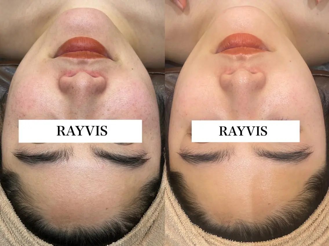 🖤RAYVIS🖤 青森店　和田のエステ・リラクイメージ