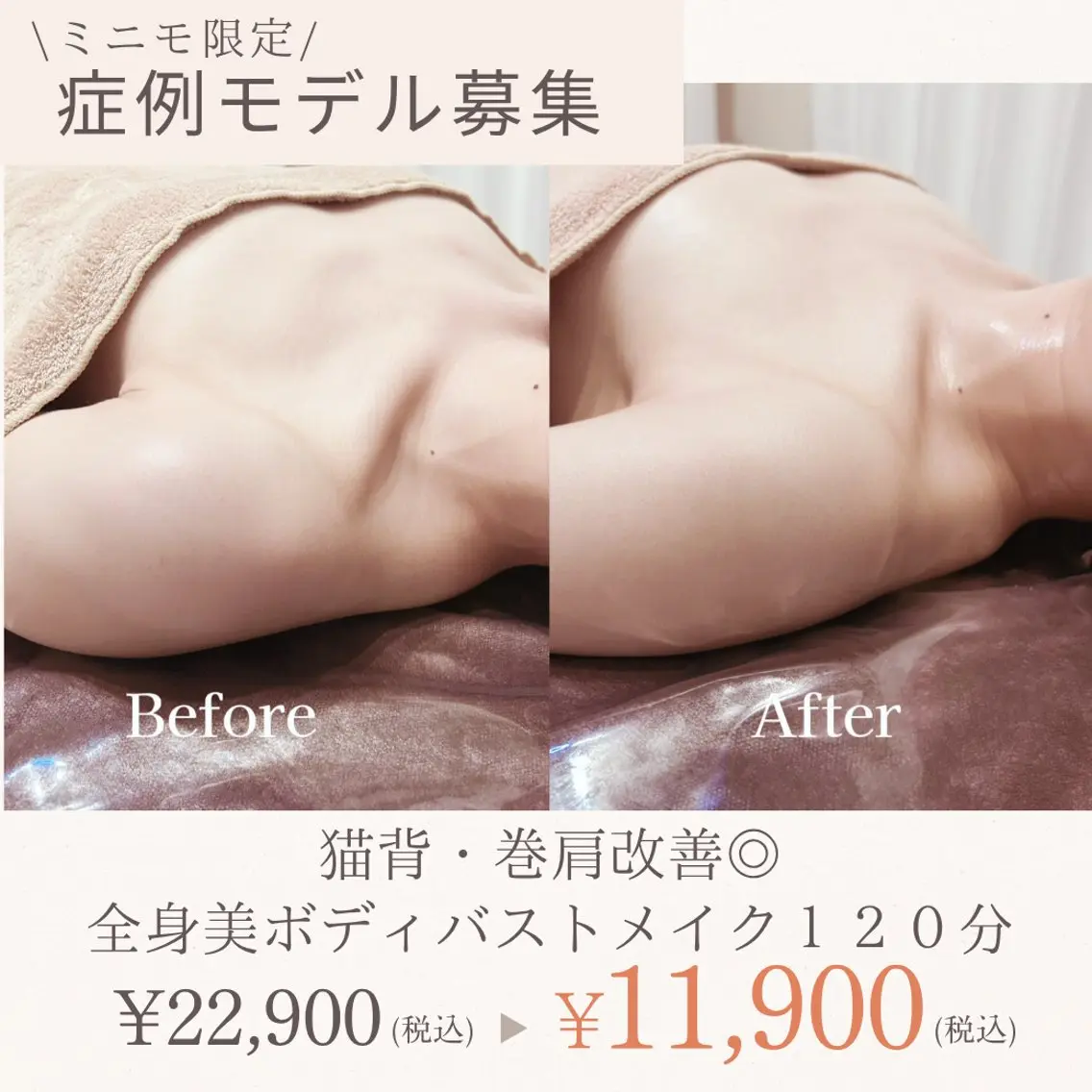 【症例モデル募集】猫背・巻肩改善◎全身美ボディバストメイク120分の写真
