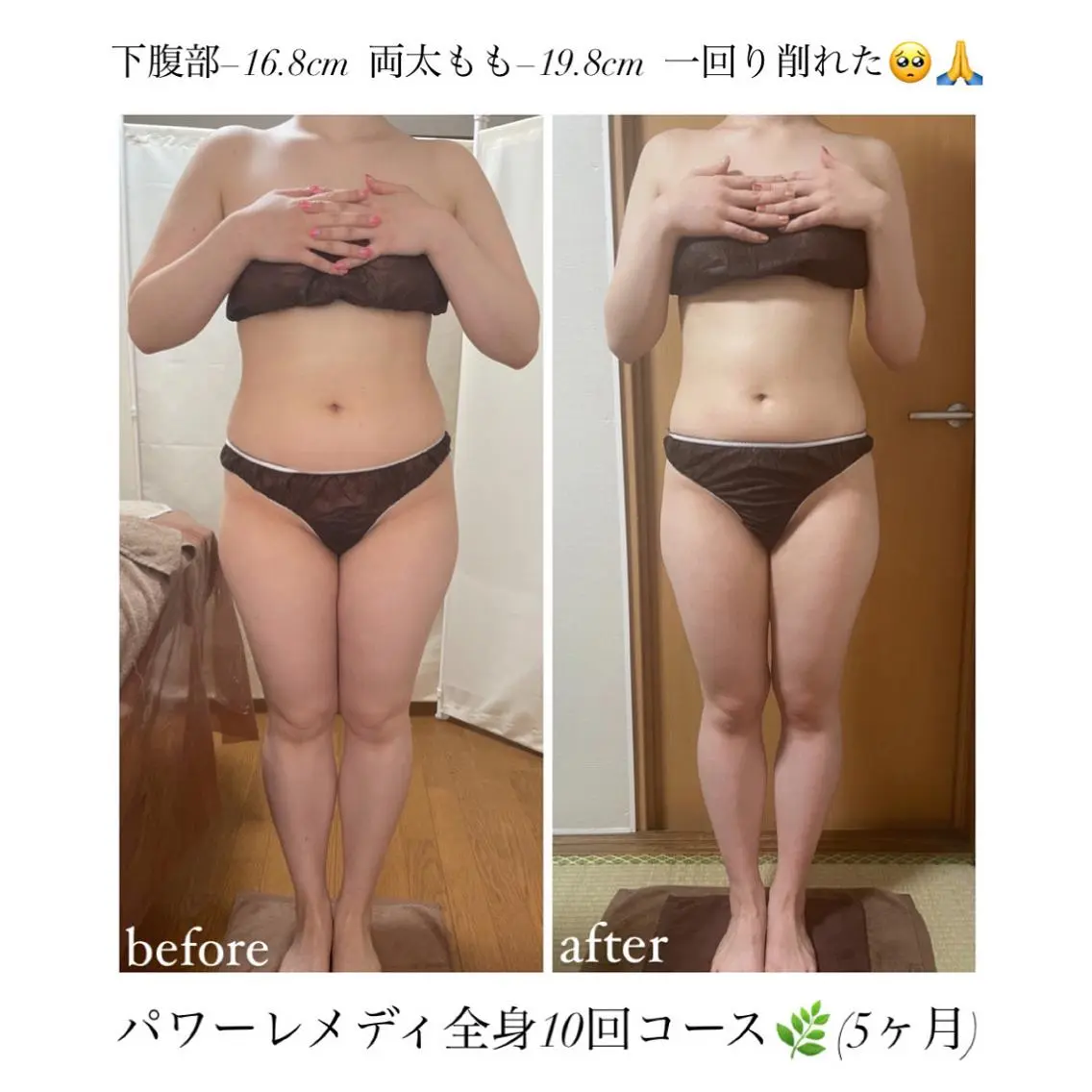 《本気痩せ×疲労改善 》 BILOOPのエステ・リラクイメージ