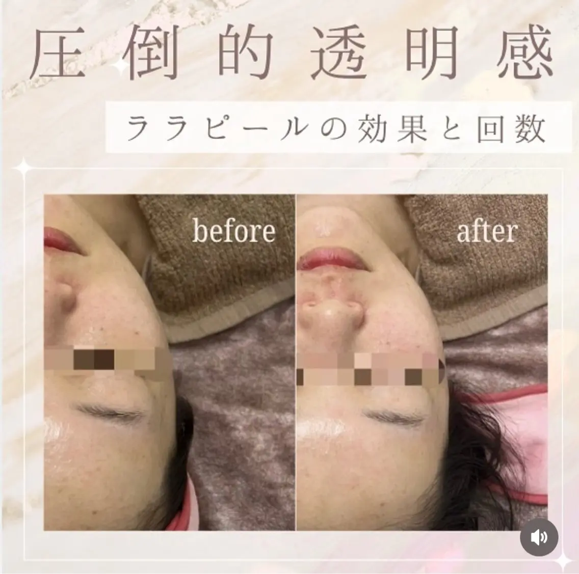 エステ 看護師が施術する ナスサロ/Emi🪽のエステ・リラクイメージ