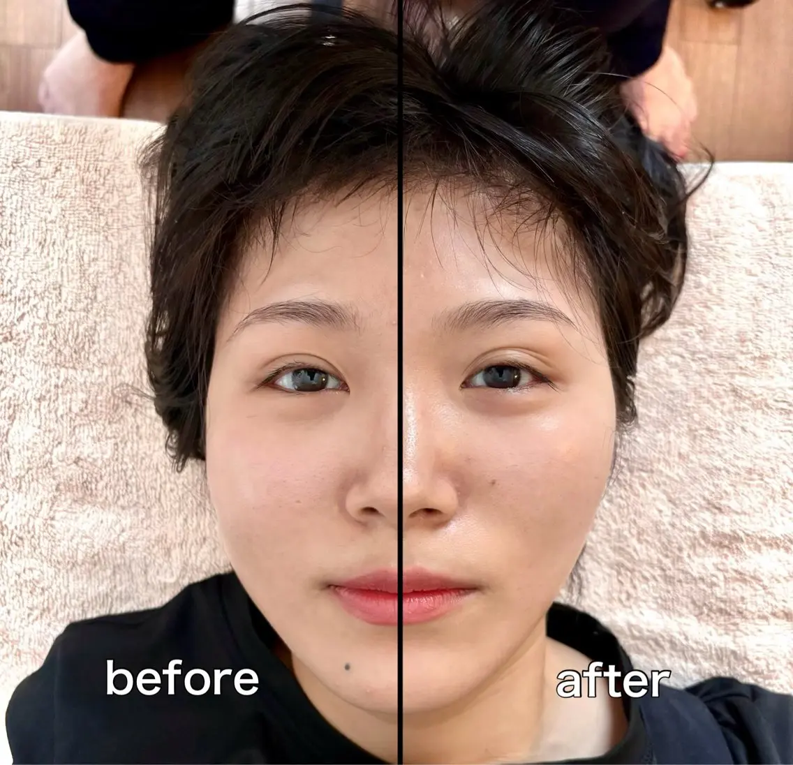 小顔整顔✨1ヶ月通い放題✨(上限あり)の写真