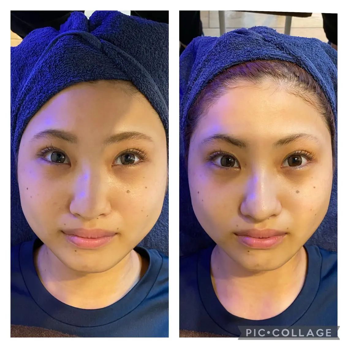 natural 小顔・美容矯正〽️のエステ・リラクイメージ