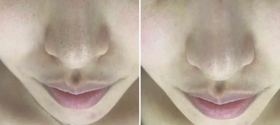 メンズ エステ 美 Faceのエステ・リラクイメージ