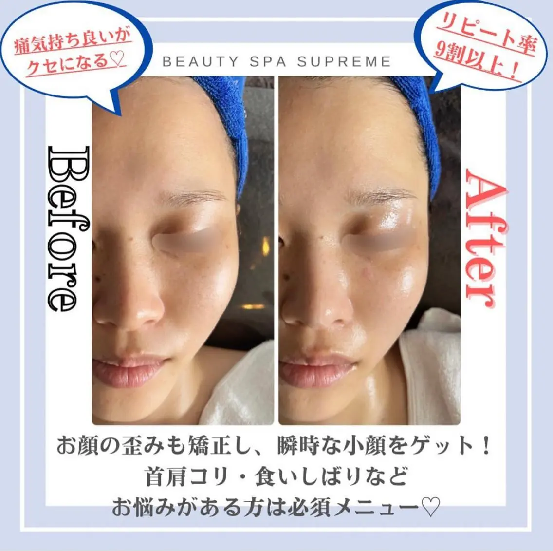 【小顔:V字形成♡リピト率✨98%】ヘッド付×3D小顔美骨矯正フェイシャル60分の写真