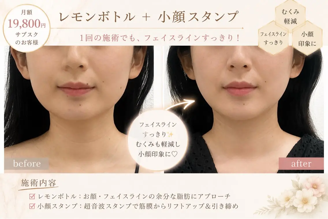 エステ 小顔痩身HALO 二宮早織のエステ・リラクイメージ
