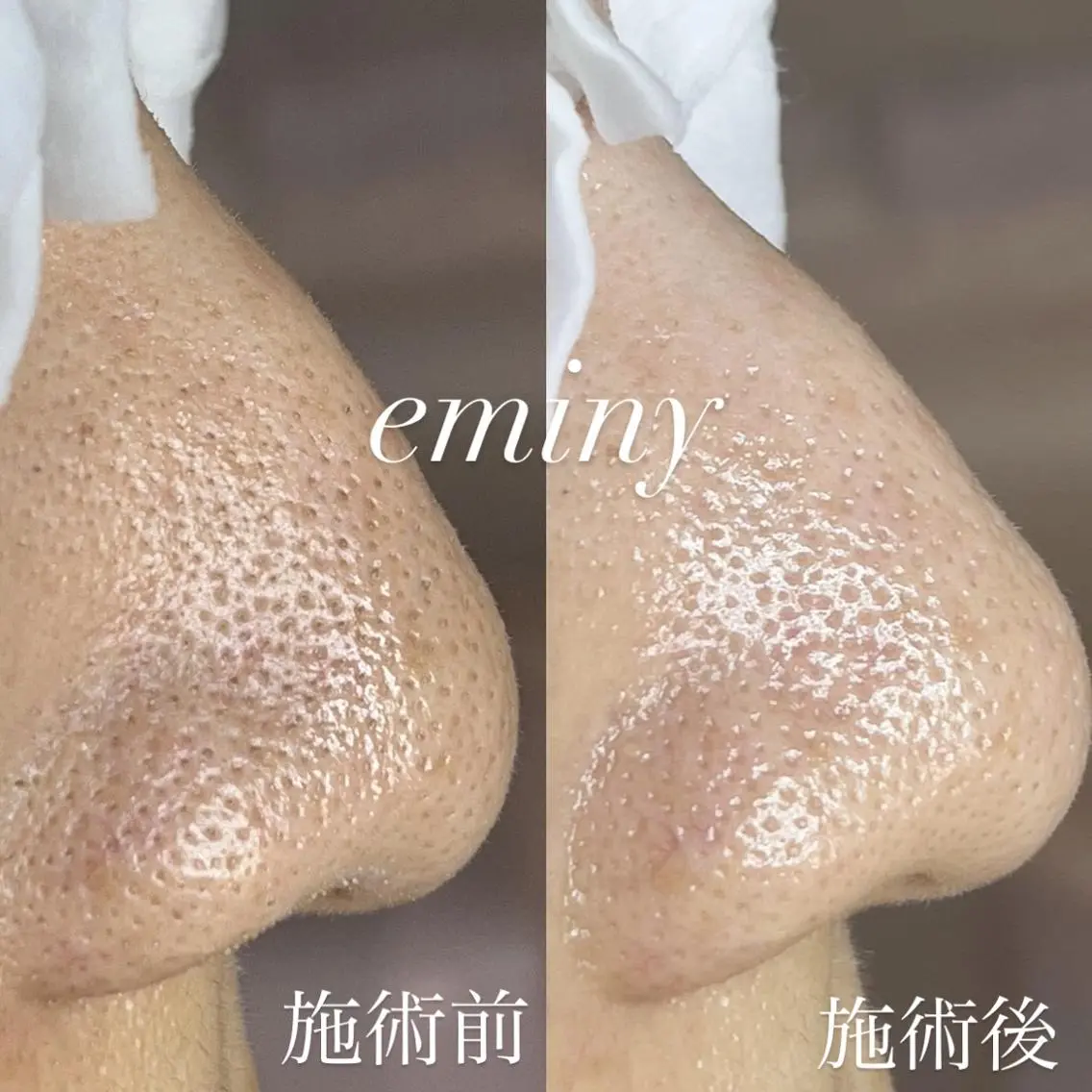 EMINY （エステティシャン）のエステ・リラクイメージ