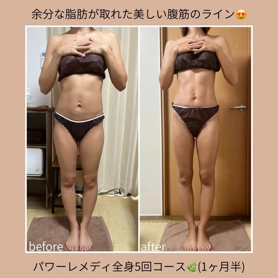 《本気痩せ×疲労改善 》  BILOOPのエステ・リラクイメージ