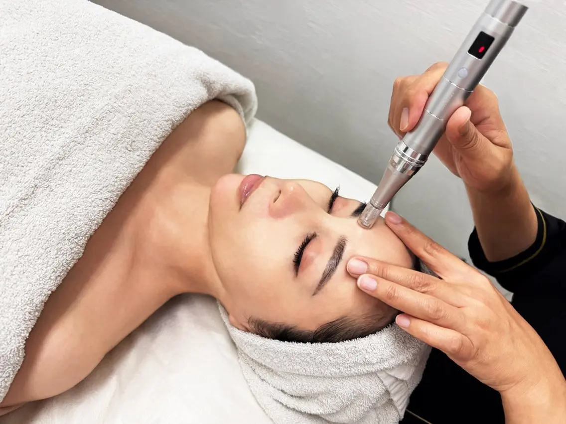 【エステ版】ソフトダーマペン💆‍♀️　60分の写真