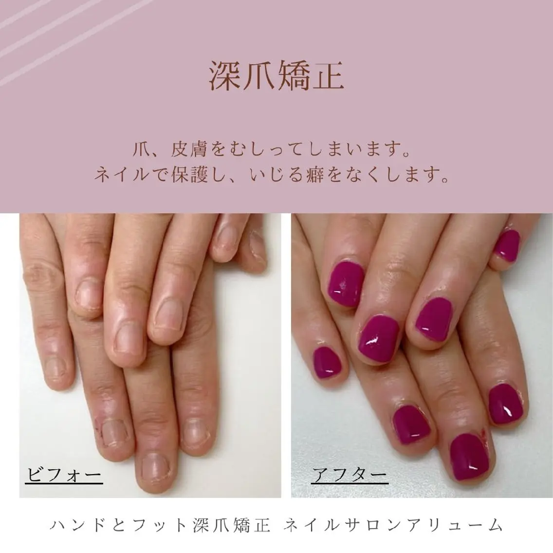 ネイル ネイルサロン アリュームのネイルデザイン