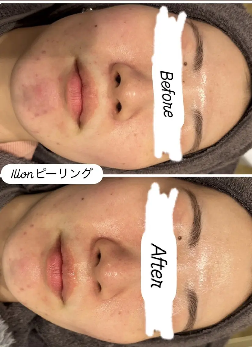 エステ 看護師 桐山 まどかのエステ・リラクイメージ