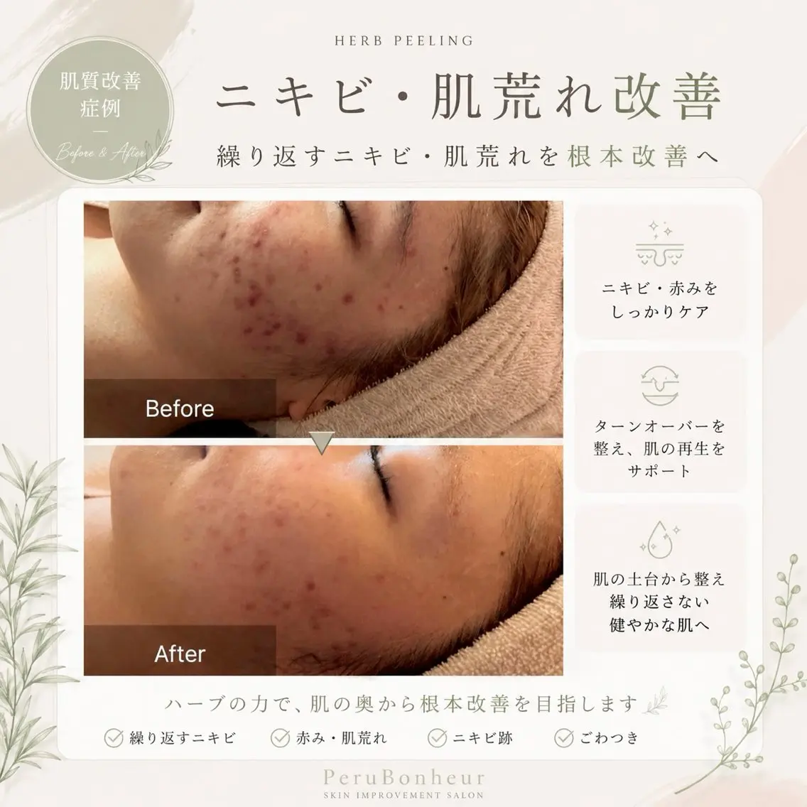 エステ 韓国美肌管理サロン ハーブ🌿MIKUのエステ・リラクイメージ