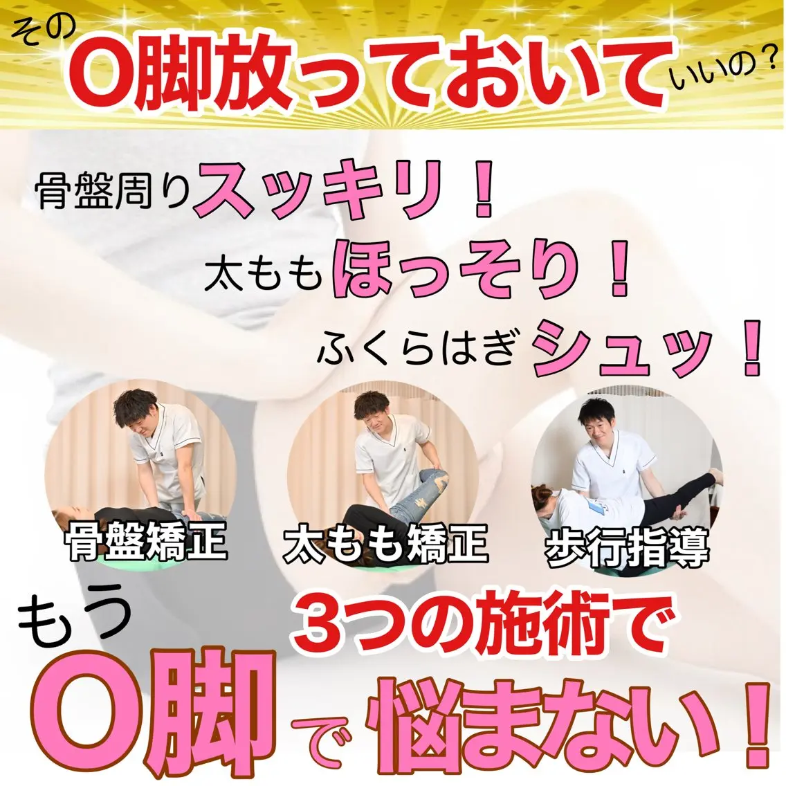 O脚×Ｘ脚矯正(脚の歪み・膝の隙間・脚のむくみ) O脚矯正☆初回体験2,750円の写真