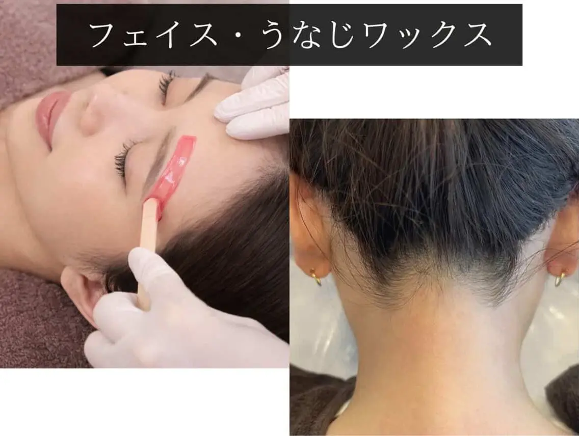 【顔の産毛・うなじのムダ毛に】フェイスワックス＋うなじワックス脱毛の写真