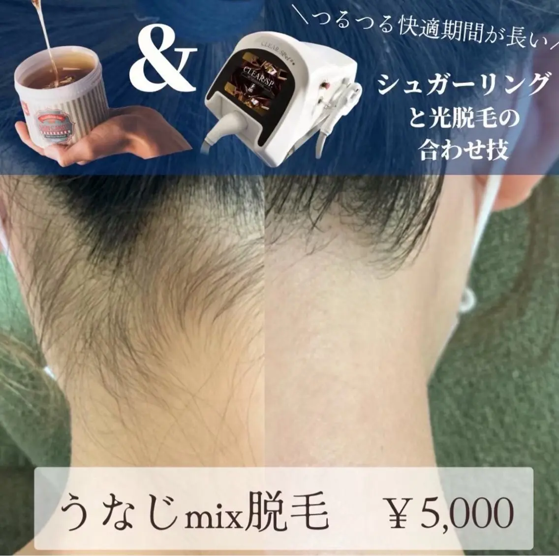emirai 🐥 AOIのエステ・リラクイメージ