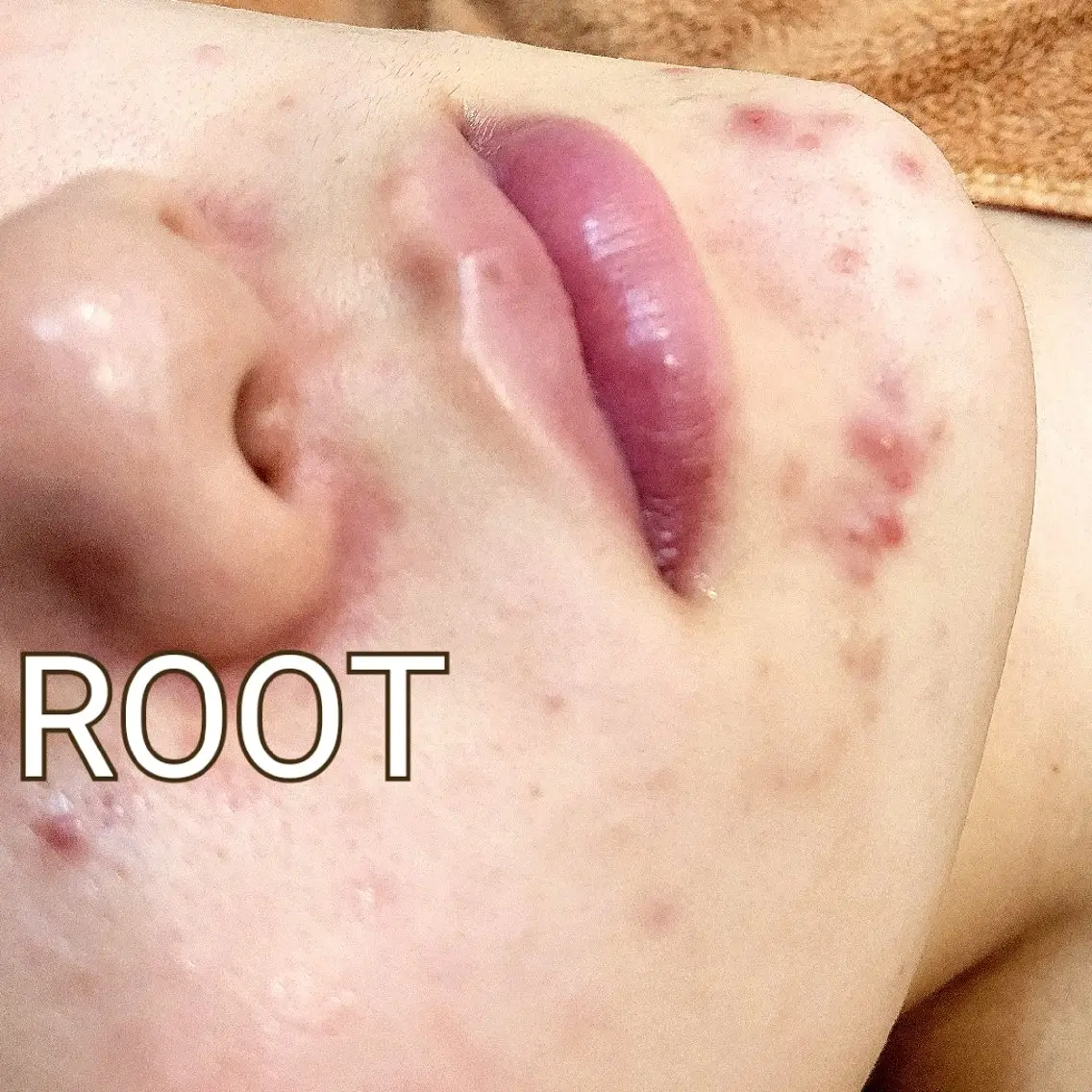 エステ 【疲れ・肌の悩み】 ROOT 渡邊のエステ・リラクイメージ