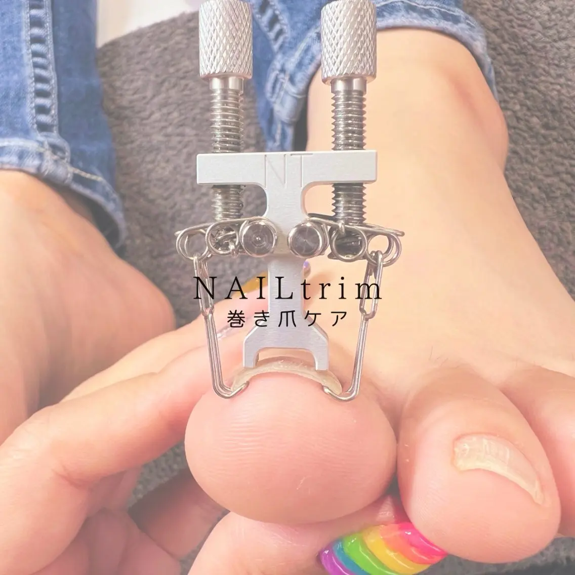 予約確認必須。巻き爪、トラブル爪カウンセリング(nailtrim)の写真