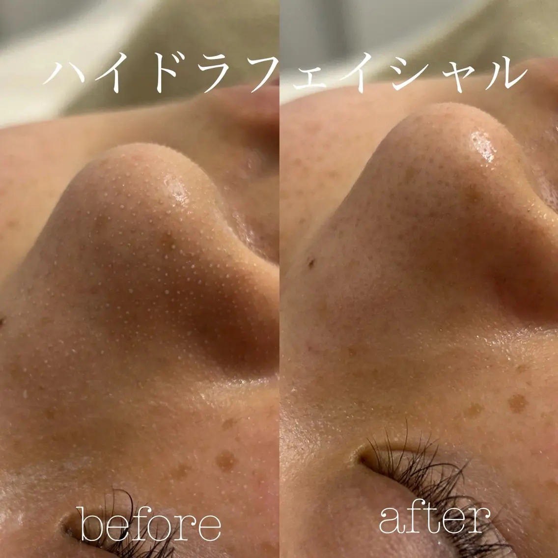 エステ フェイシャルサロン CHIARA 荒田のエステ・リラクイメージ