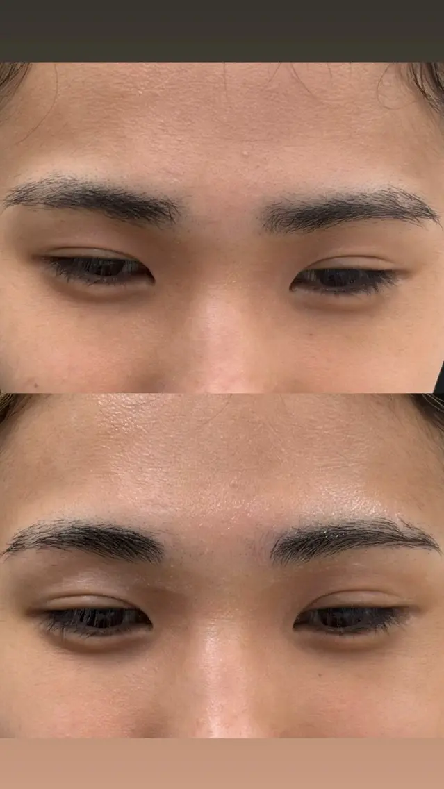 眉毛カットの写真