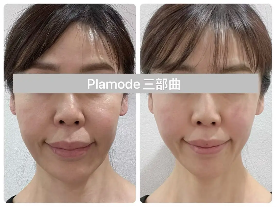 マツエク・マツパ エステ リラク 愛維美水光美肌専門店 メンズレディースokのエステ・リラクイメージ