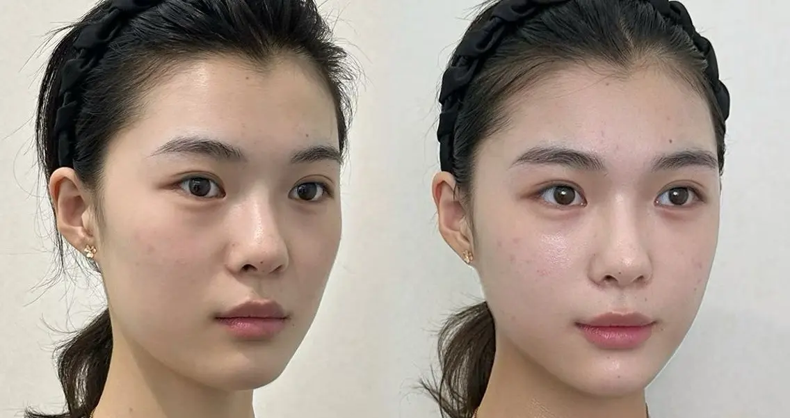 マツエク・マツパ aliaハーブ水光店 エステティシャン募集のエステ・リラクイメージ