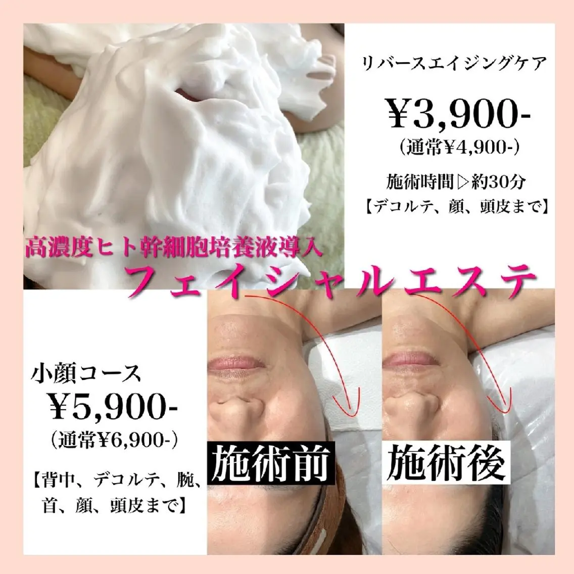 エステ プライベートサロン yurikoの眉毛・アイブロウイメージ