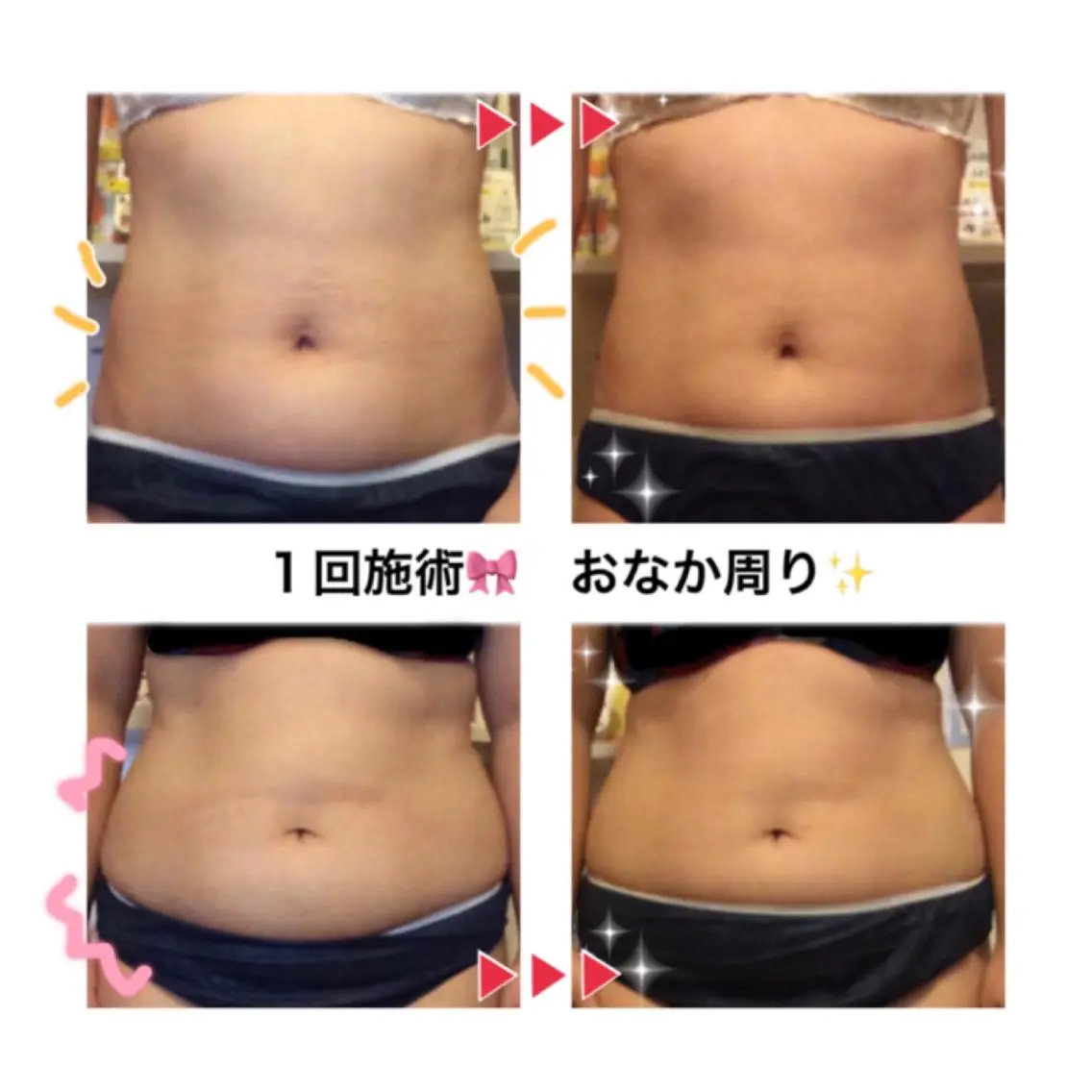 エステ リラク ダイエット・美肌ケア fleurのエステ・リラクイメージ
