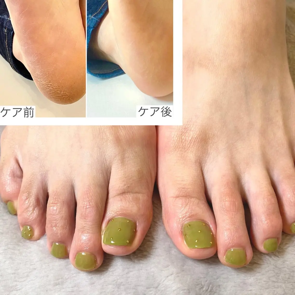 初回オフ無料!足裏つるつるケア付き♡フット ワンカラー(両親指にストーンアートが付くデザイン)の写真