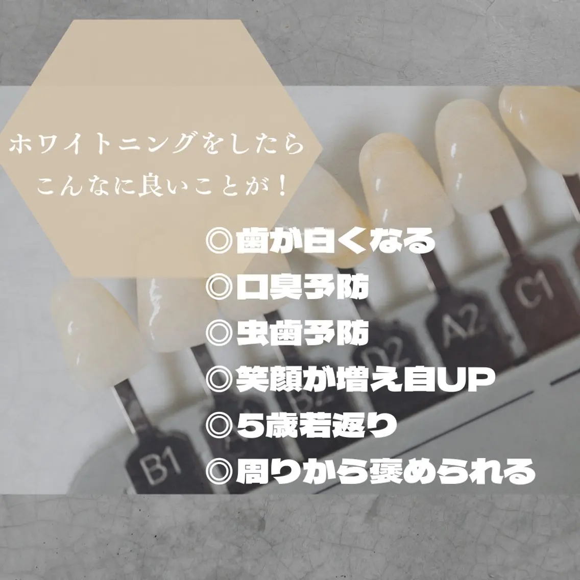その他 ホワイトニング ショップ津店のその他イメージ