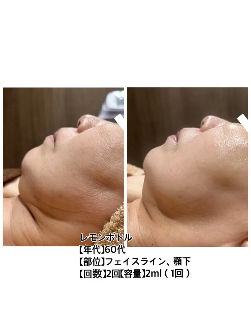二重アゴ撃退！フェイスラインすっきり小顔ケア🔥の写真