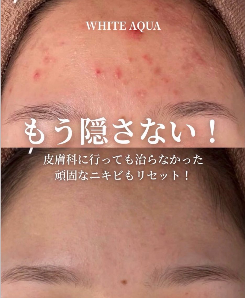 エステ 柏/肌管理専門店/ ⭐️サトウレノン🌟のエステ・リラクイメージ