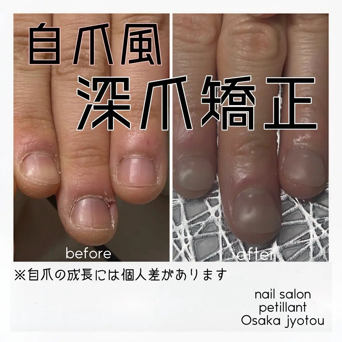 ネイル 長さ出し nail salon petillantのネイルデザイン