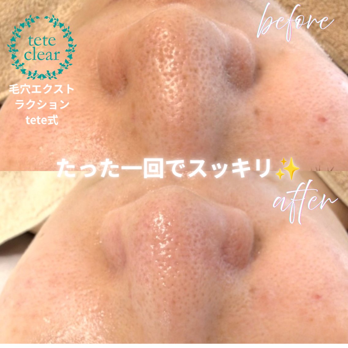 エステ SOLEILnail &beautyのエステ・リラクイメージ